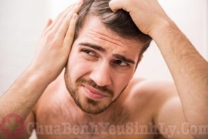 Đàn ông rụng tóc nhiều có phải bị yếu sinh lý?-2