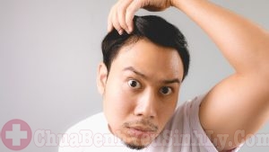 Đàn ông rụng tóc nhiều có phải bị yếu sinh lý?-3