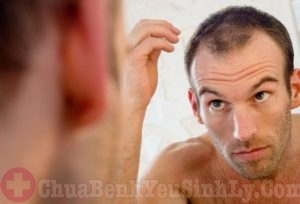 Đàn ông rụng tóc nhiều có phải bị yếu sinh lý?-1